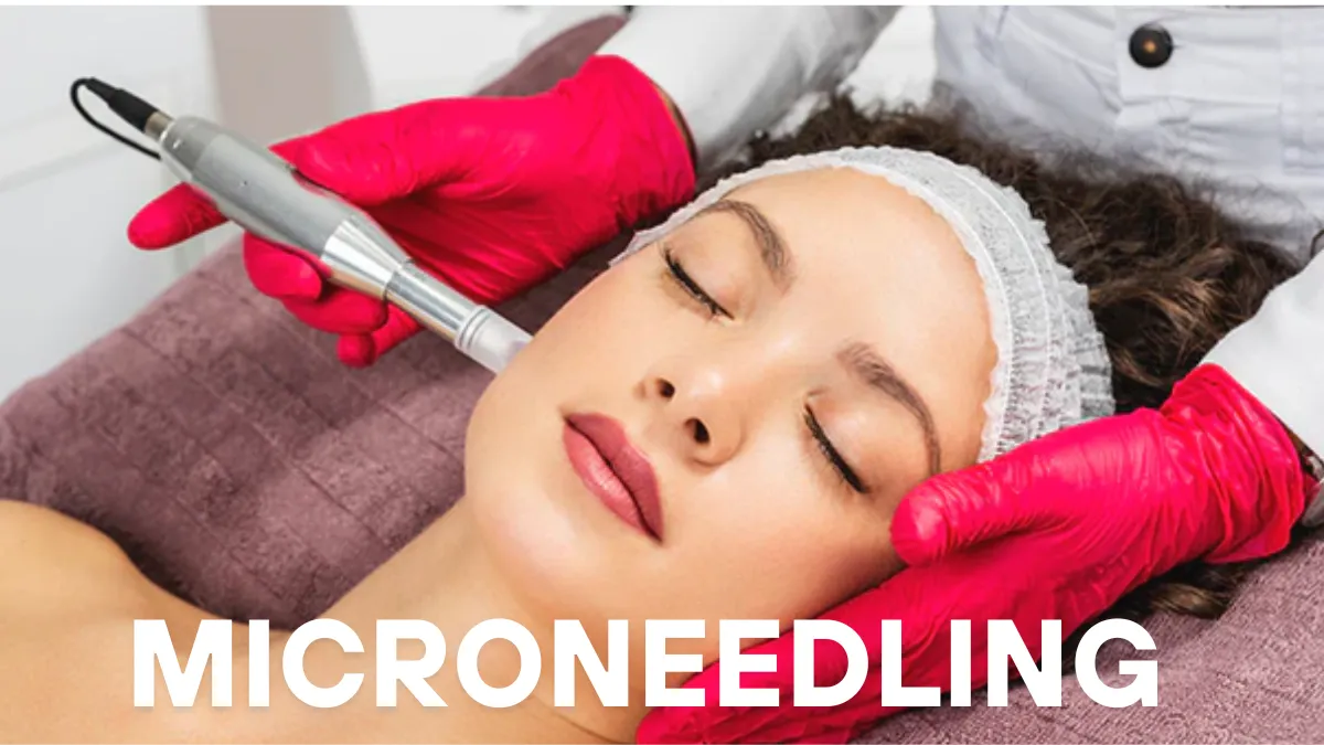 A professional microneedling facial treatment with a dermapen device